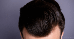 Best Mens Hair Systems