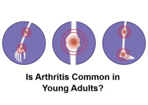 Is Arthritis Common in Young Adults?
