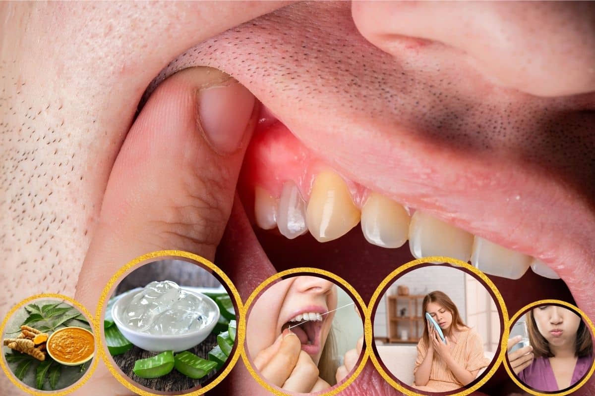 Heal Swollen Gums
