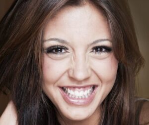 gummy smile in islamabad